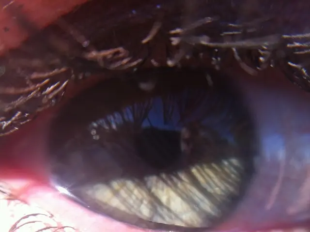 Methods for alleviating swollen eyes due to crying: 8 DIY solutions